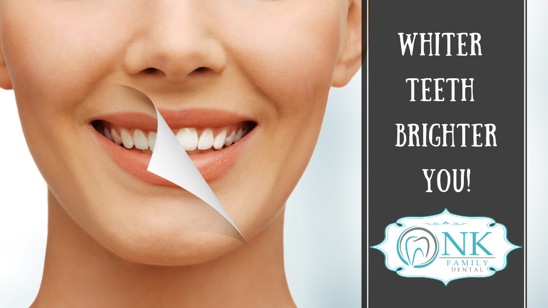 whiter teeth &ndash; brighter you