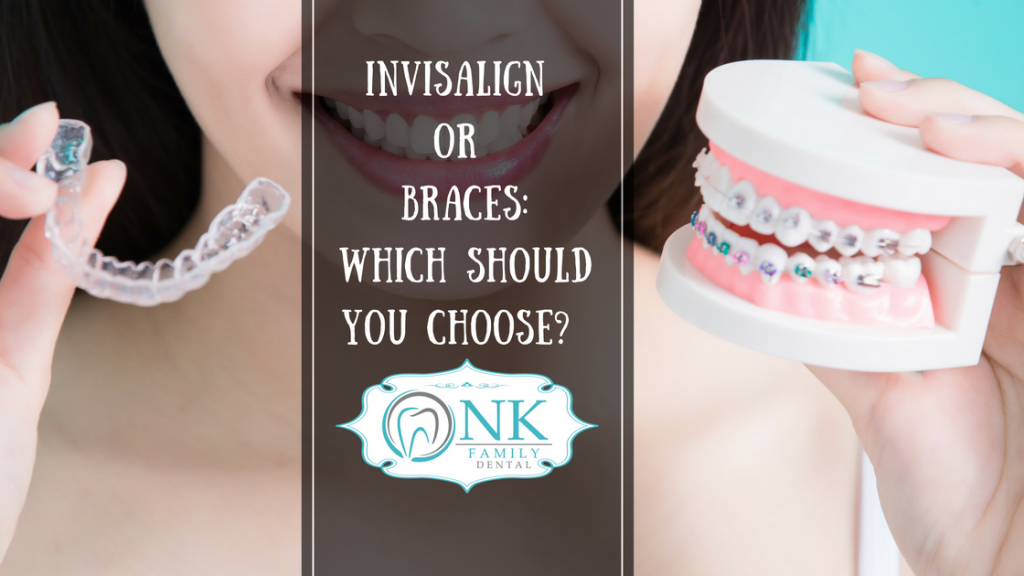 Invisalign or braces: Which should you choose?