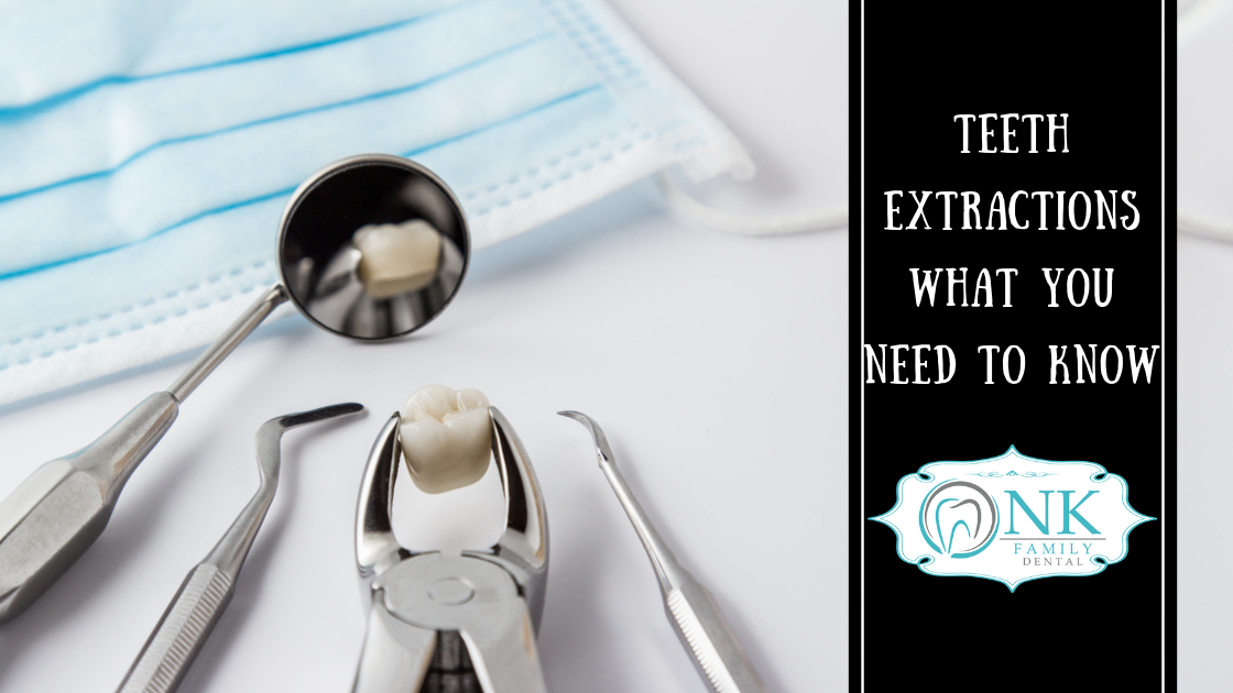 Questions About Teeth Extractions? | NK Family Dental ...