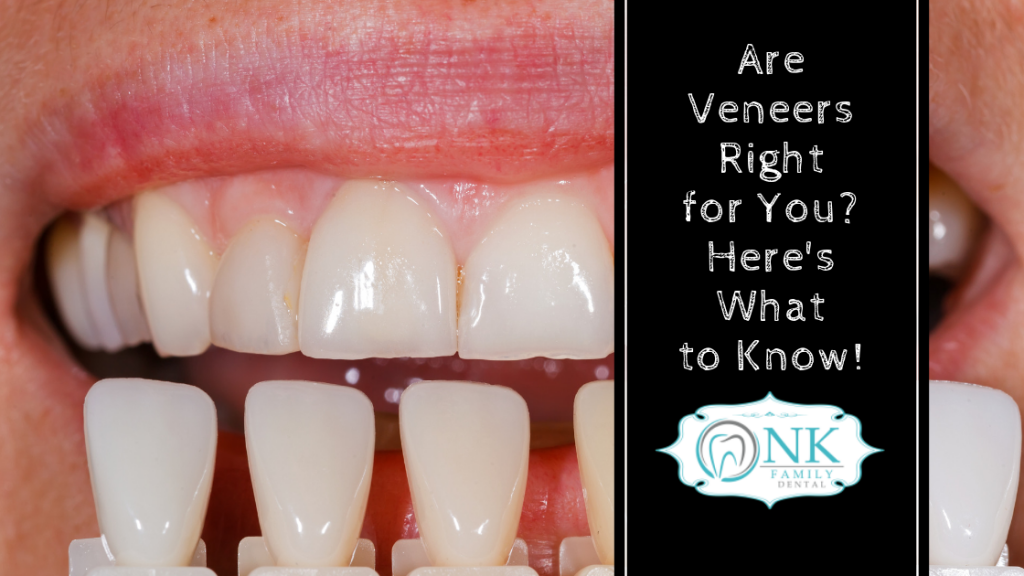 are veneers right for you what to know before getting veneers 1024x576