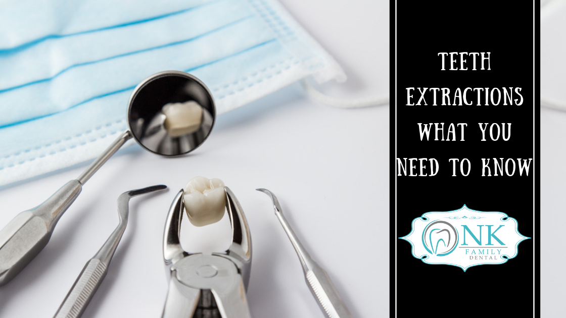 teeth extractions what you need to know