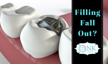 Lost a filling, Filling fell out, when a tooth filling falls out, Chicago emergency dentist