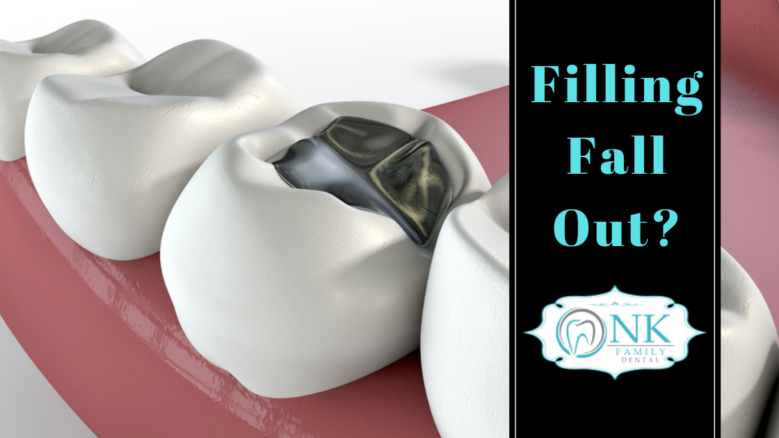 how to handle a lost tooth filling