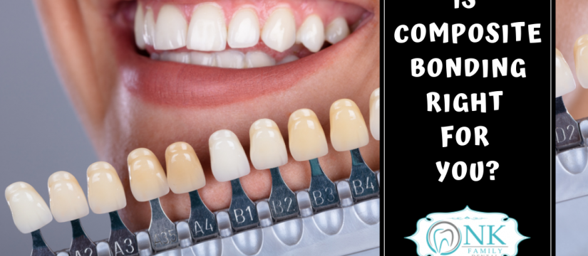 dental bonding, composite bonding, Chicago dentist, Chicago tooth implants