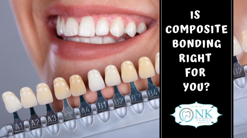 dental bonding, composite bonding, Chicago dentist, Chicago tooth implants
