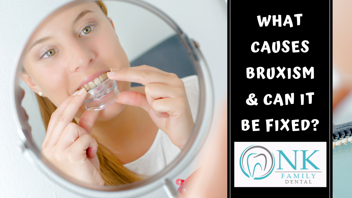 What Causes Bruxism, and Can it Be Fixed?