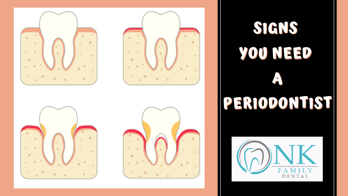 signs you need a periodontist
