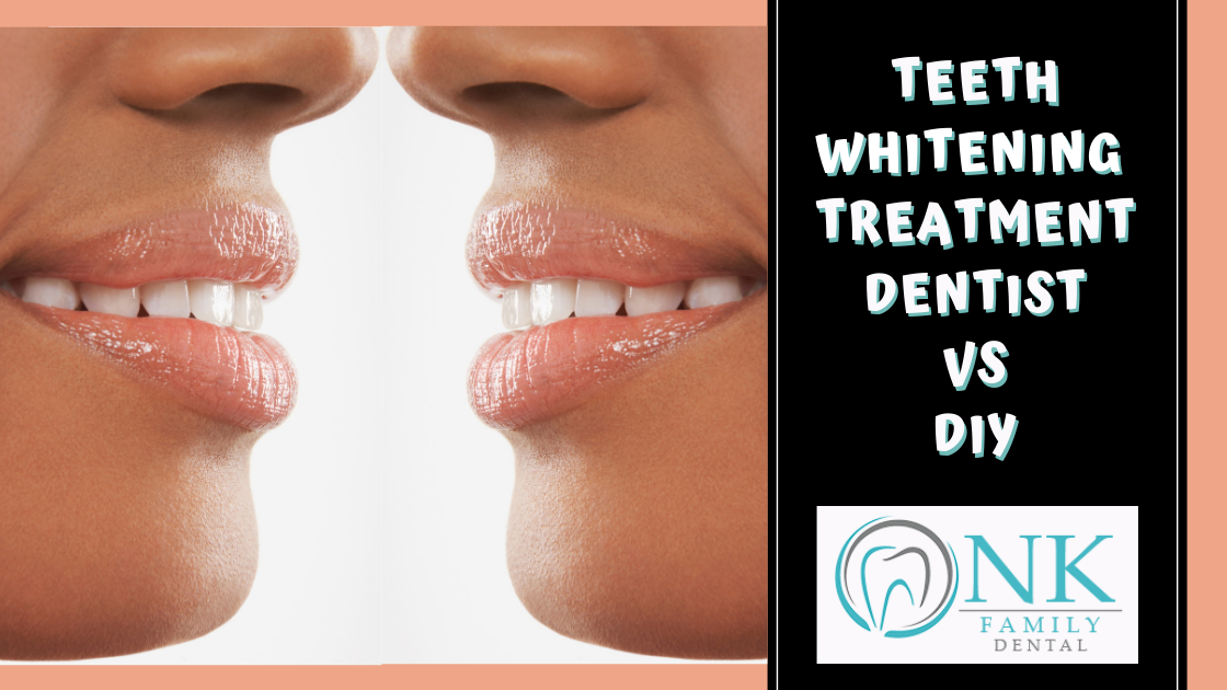 tooth whitening