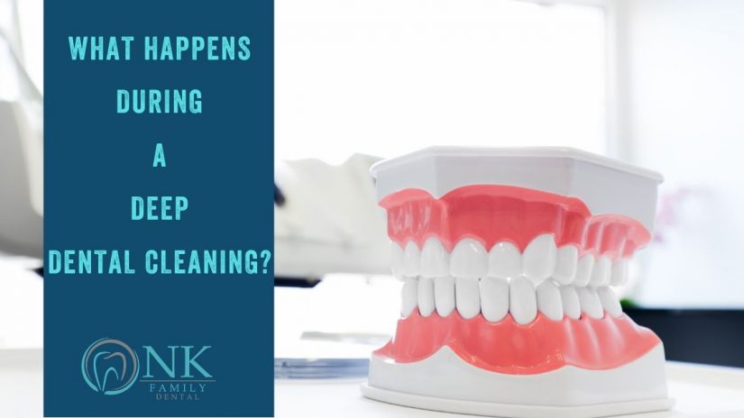 Deep Dental Cleaning