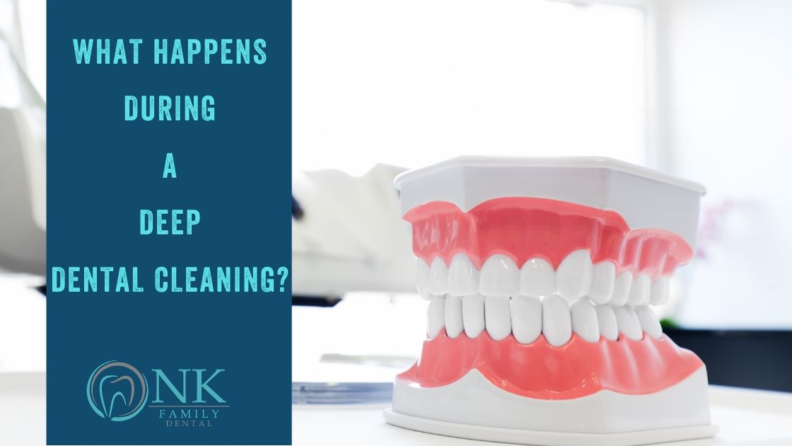 nk deep dental cleaning