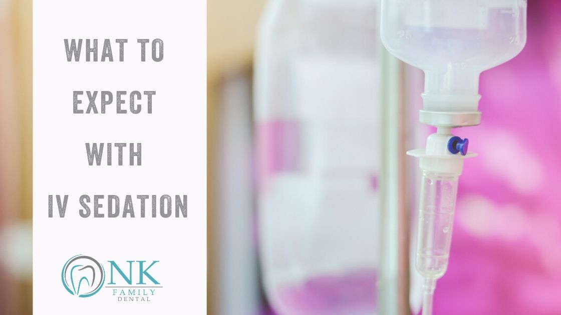 nk expect iv sedation (1)