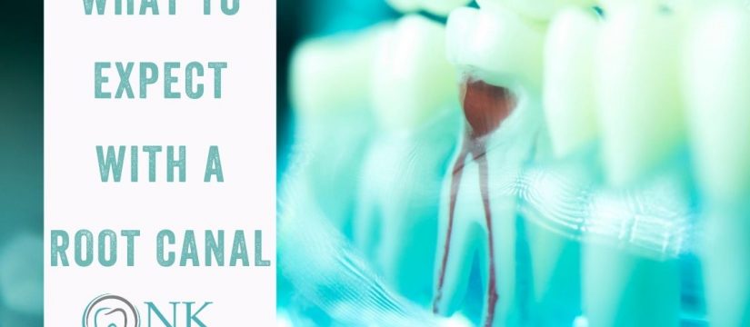 Root Canal NK Family Dentist