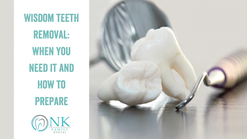 Wisdom Teeth Removal: When You Need It and How to Prepare ...