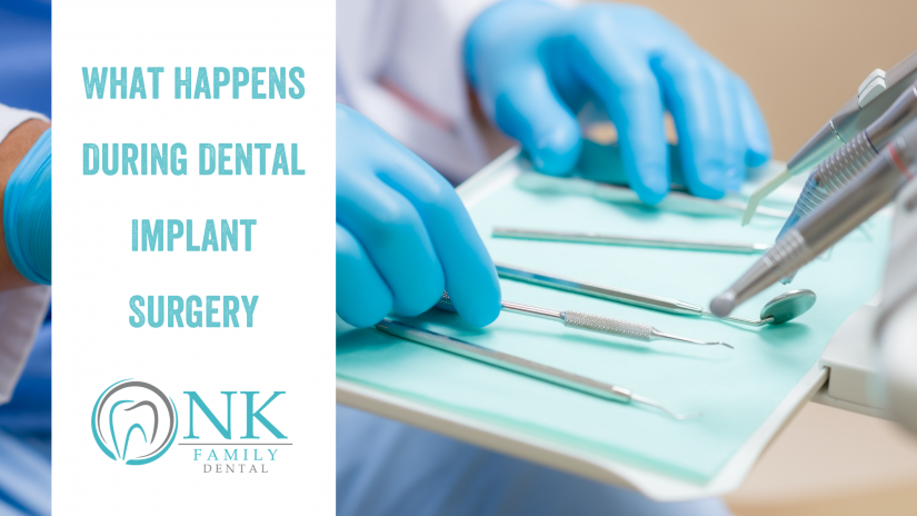 What Happens During Dental Implant Surgery