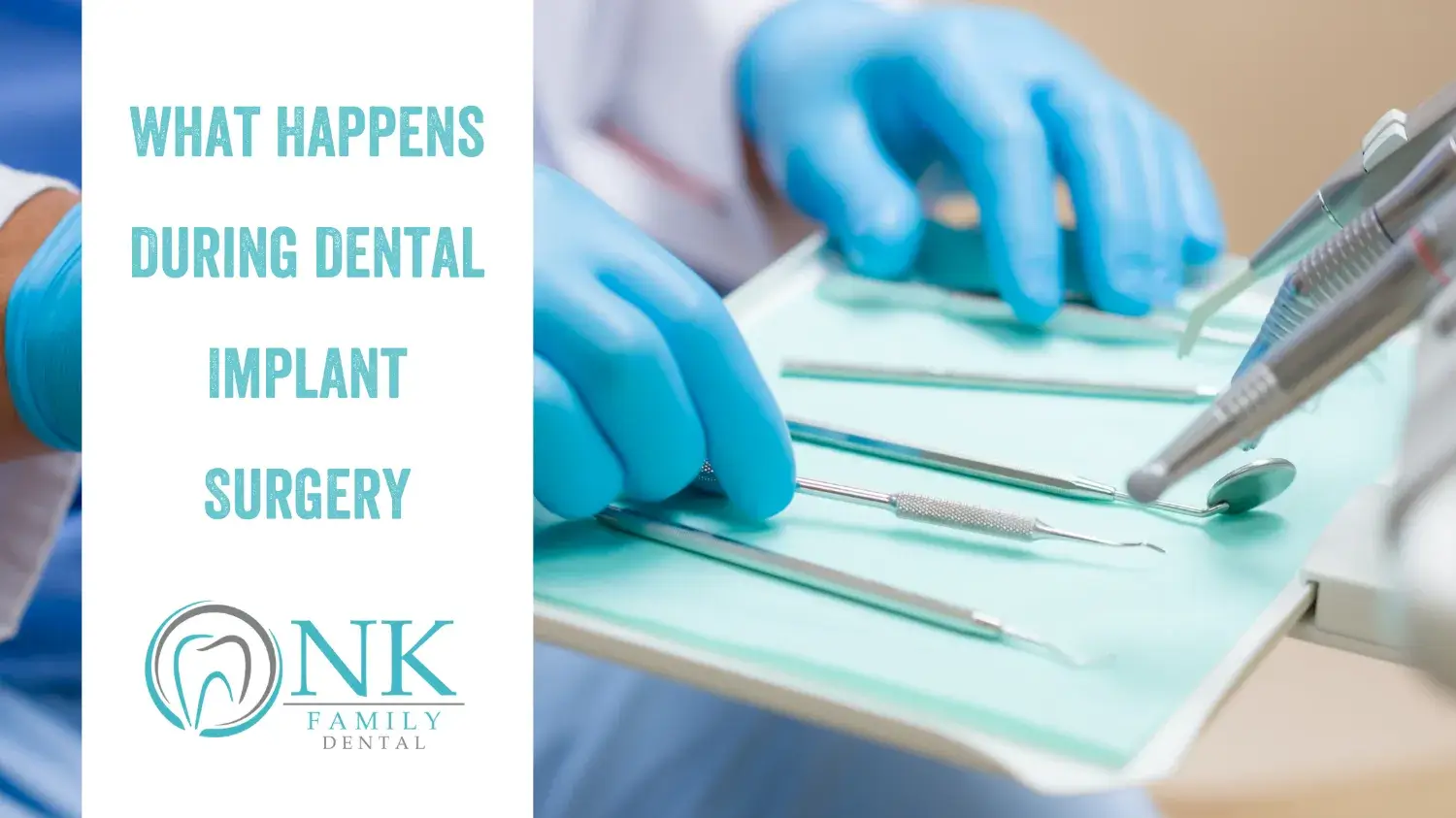 nk family dental blog what happens during dental implant surgery