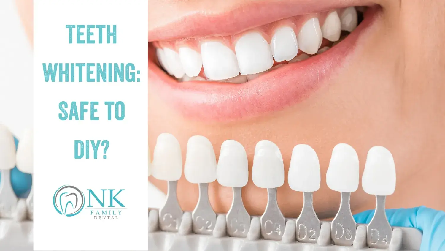 teeth whitening2 july2021 1