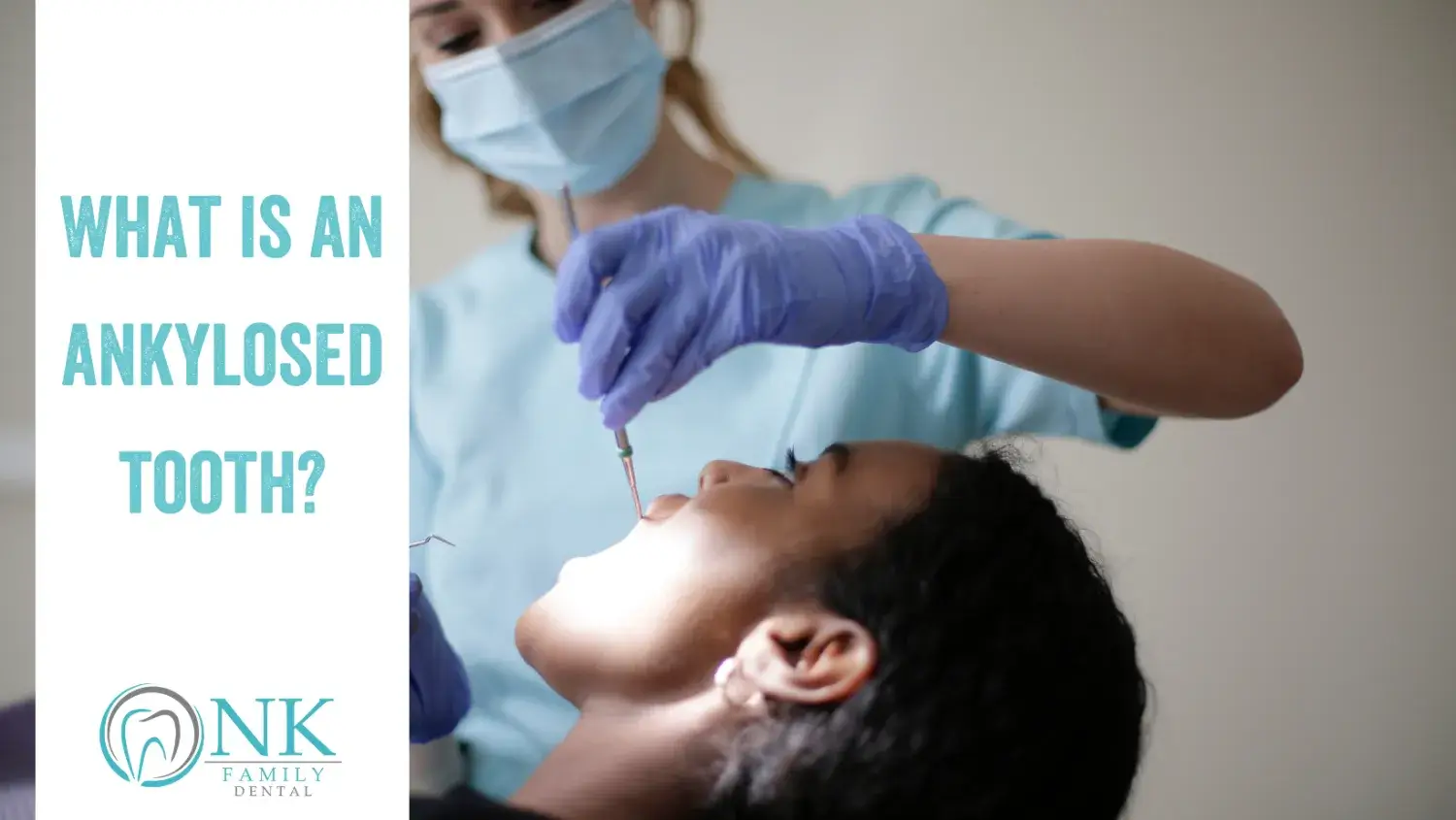 what is an ankylosed tooth nk family dental blog 2 january2022