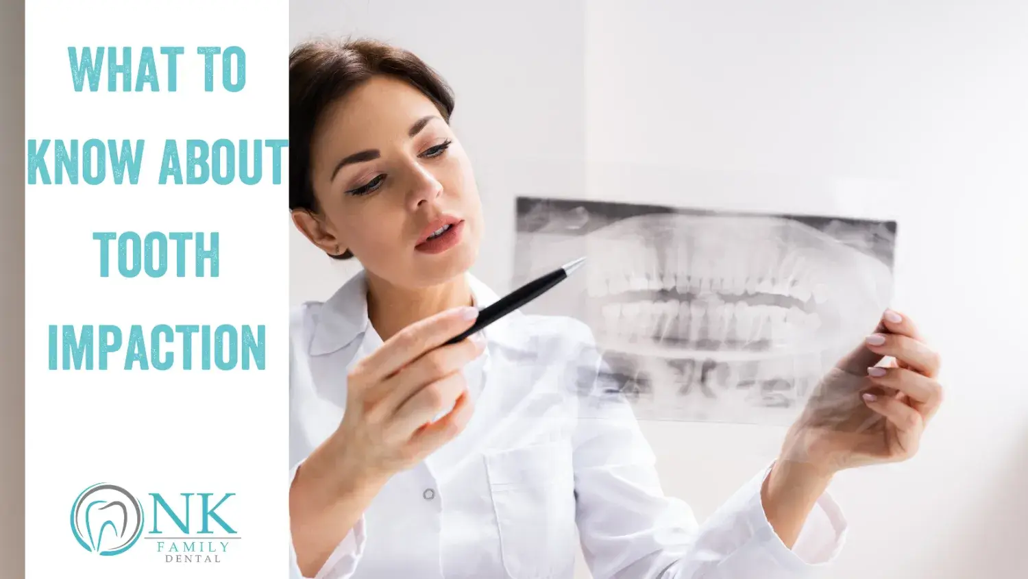 what to know about tooth impaction nk family dental blog 1 december2021