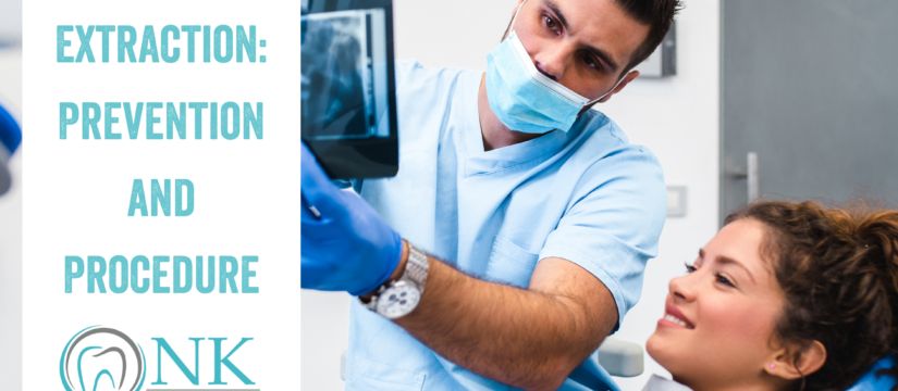 Tooth Extraction: Procedure and Prevention