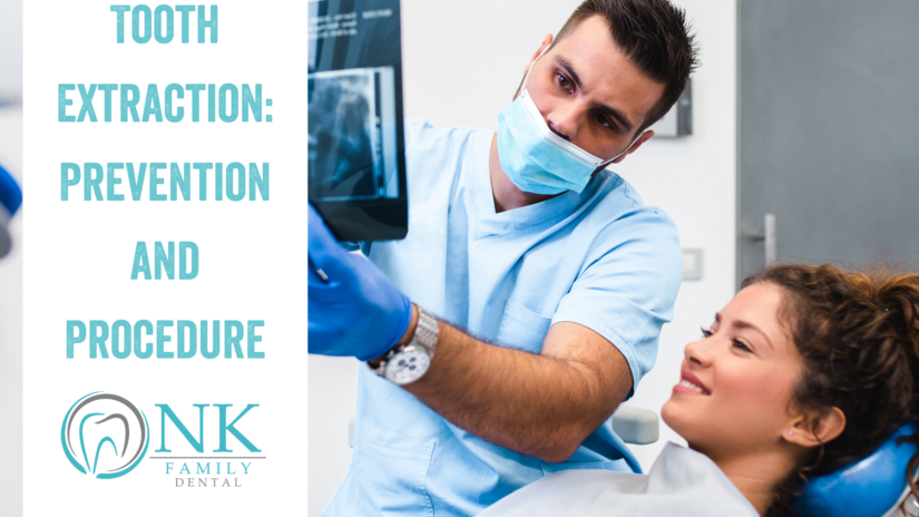 Tooth Extraction: Procedure and Prevention