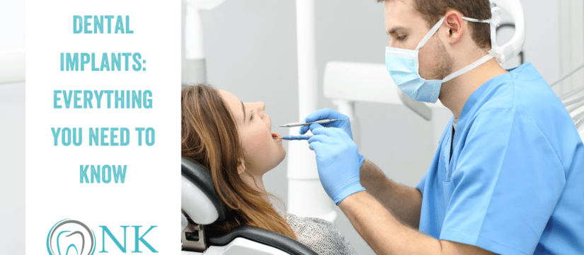 All-on-Four Dental Implants: Everything You Need to Know