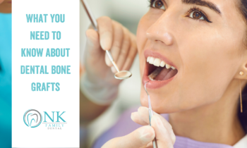 What You Need To Know About Dental Bone Grafts