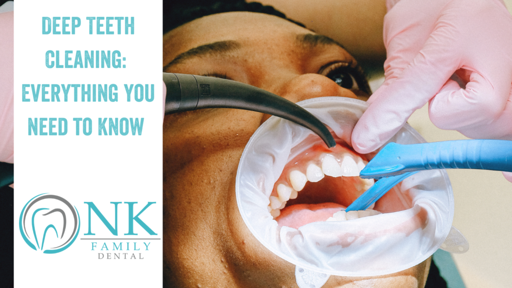 Deep Teeth Cleaning Everything You Need To Know NK Family Dental