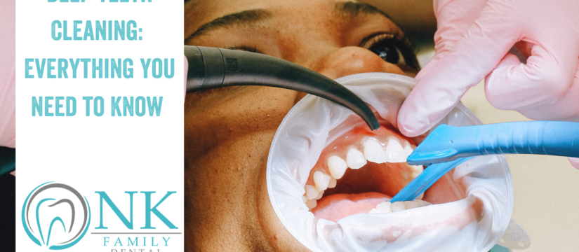Deep Teeth Cleaning: Everything You Need To Know