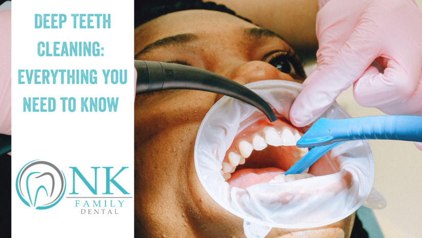 Deep Teeth Cleaning: Everything You Need To Know