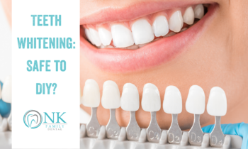 Teeth Whitening: Is it Safe to DIY?