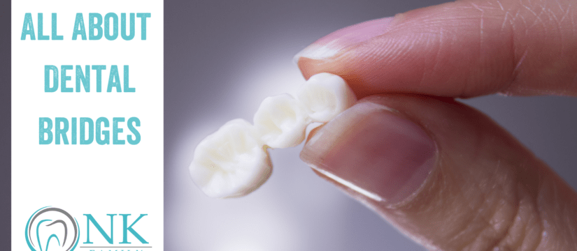 All About Dental Bridges