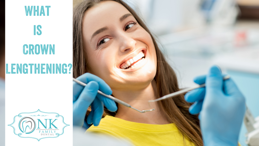 What is Crown Lengthening?