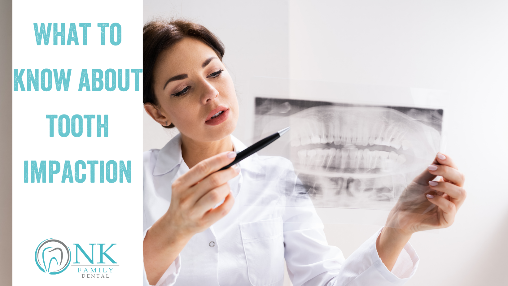 what to know about tooth impaction nk family dental blog #1 (december2021)