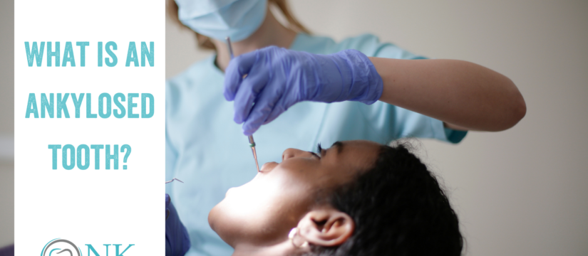 What is an Ankylosed Tooth?