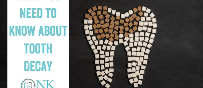 What You Need to Know About Tooth Decay