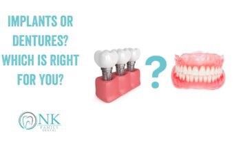 Implants or Dentures? Which is Right for You?