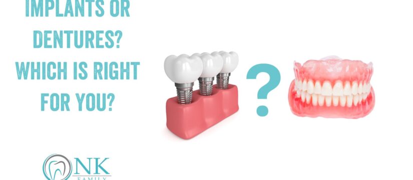 Implants or Dentures? Which is Right for You?