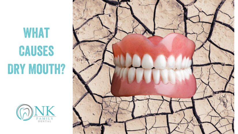 What Causes Dry Mouth?