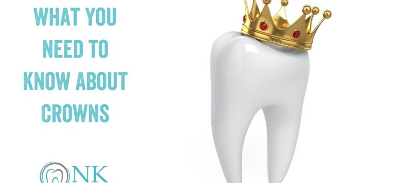 What You Need to Know About Crowns
