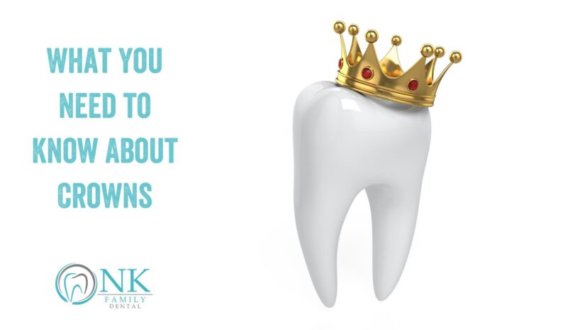 What You Need to Know About Crowns