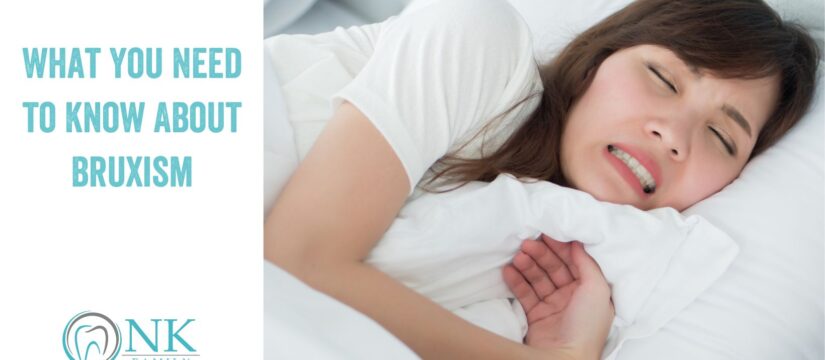 What You Need to Know About Bruxism