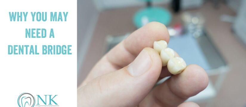 Why You May Need a Dental Bridge