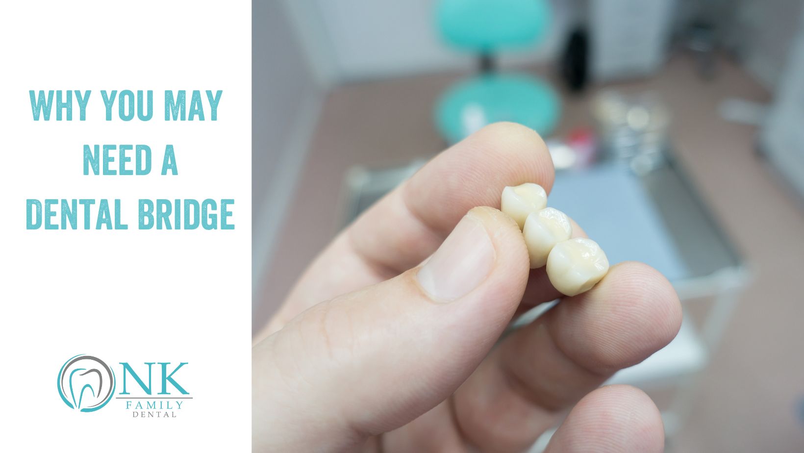 nk family dental august 2023 blog post #2 dental bridge