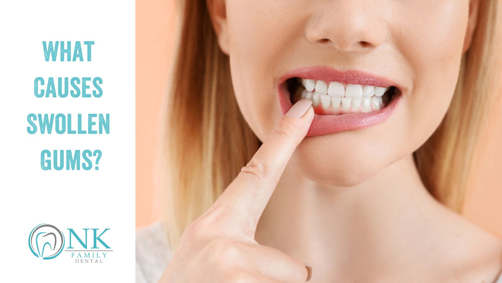 nk family dental october 2023 blog post #1 swollen gums