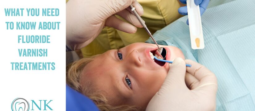 What You Need to Know About Fluoride Varnish Treatments