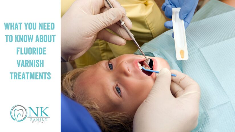 What You Need to Know About Fluoride Varnish Treatments