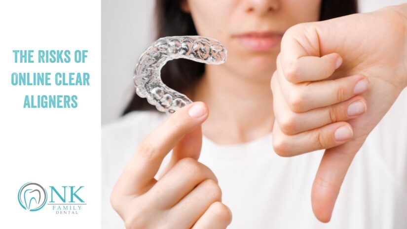 The Risks of Online Clear Aligners