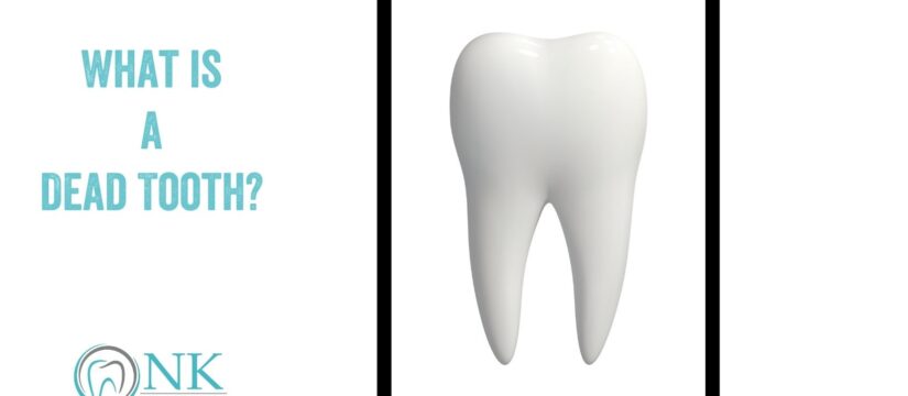 What Is a Dead Tooth?
