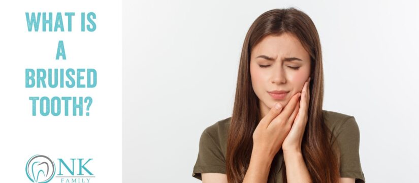 What is a Bruised Tooth?