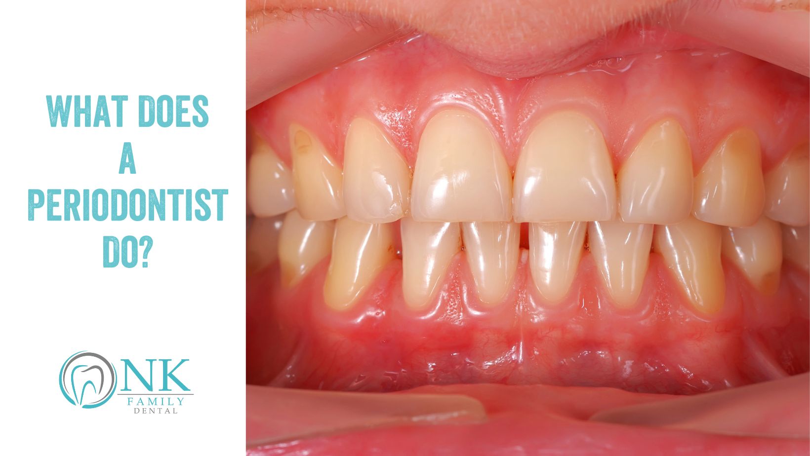 nk family dental september blog post 2 periodontist